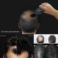 6 Bottles Brilliant Top Hair Building Fibers