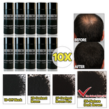 10 Bottles Hair Direction Hair Building Fibers | 27.5g / 0.97oz Per Bottle