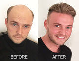 Male Lace Top Human Hair Piece for Covering bold / thin top